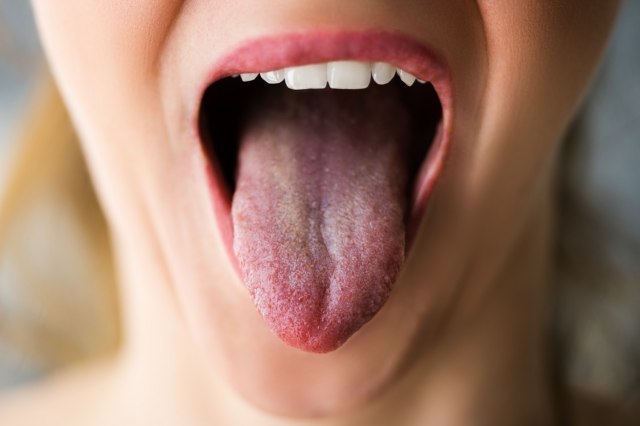 Kakvo vam je zdravlje vidi se po ustima – nekoliko znakova za uzbunu